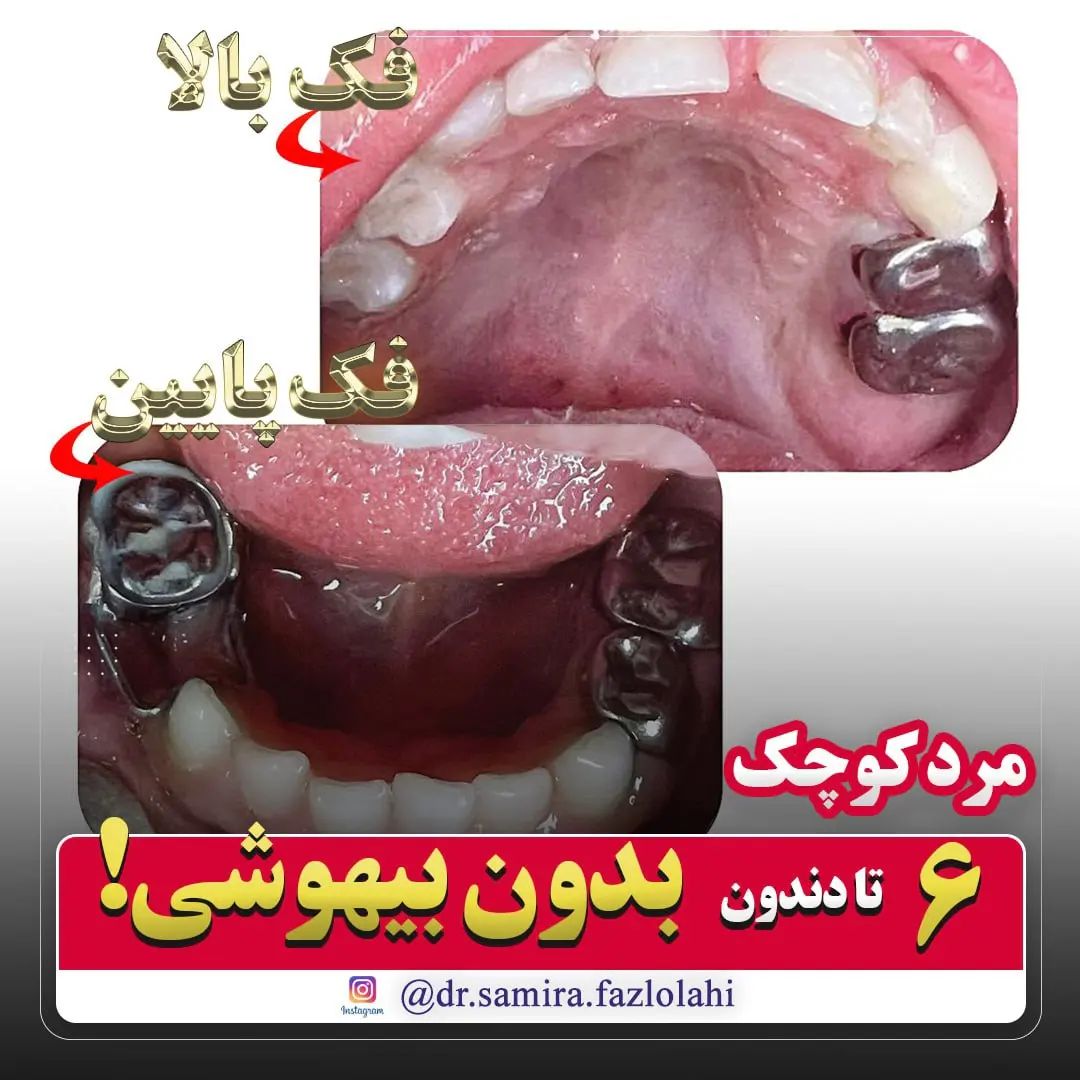 درمان تحت بیهوشی