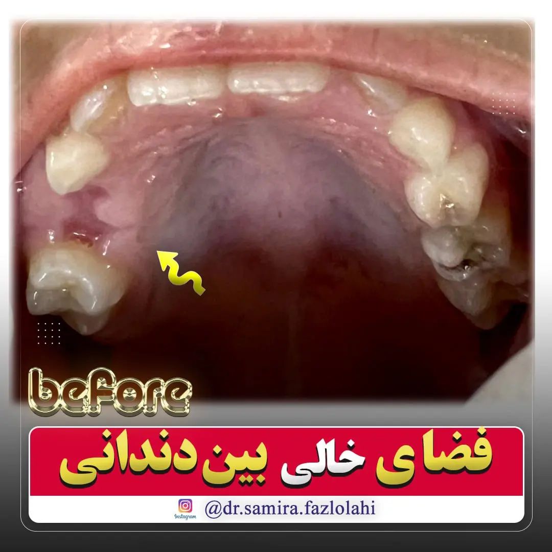 خدمات ترمیم دندان
